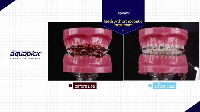 Aquapick Cordless Oral Irrigator AQ-230 English смотреть онлайн