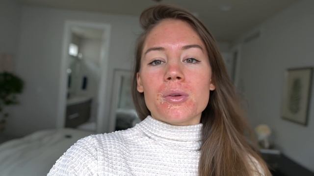 I DID A CHEMICAL PEEL + MICRONEEDLING смотреть онлайн