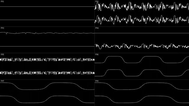 X68000 - "griot" by hizmi - Oscilloscope View смотреть онлайн
