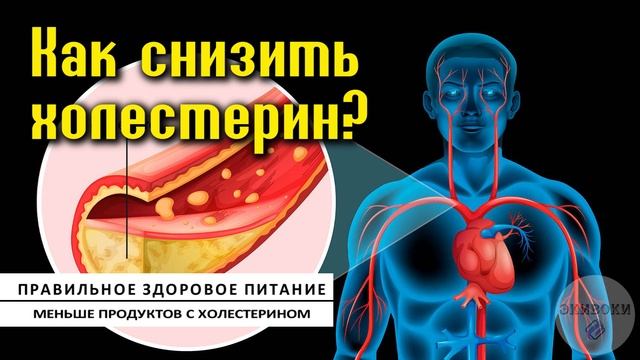 #холестерин #здоровье #атеросклероз КАК СНИЗИТЬ УРОВЕНЬ ХОЛЕСТЕРИНА. смотреть онлайн