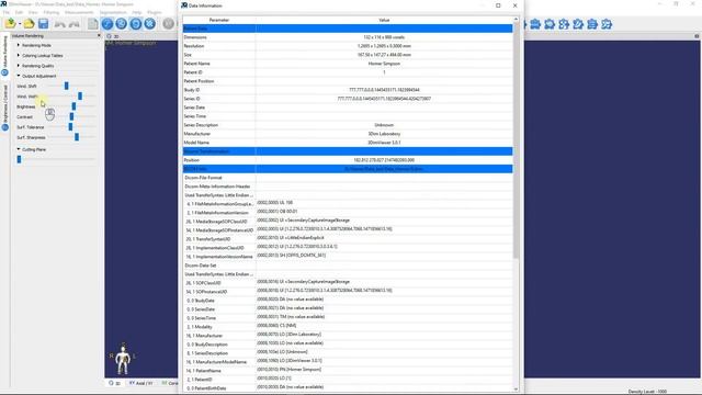 3DimViewer 3.x Tutorial: DICOM data anonymization смотреть онлайн