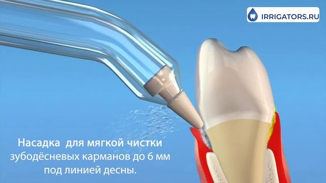 Пародонтологическая насадка Waterpik PP-100E смотреть онлайн