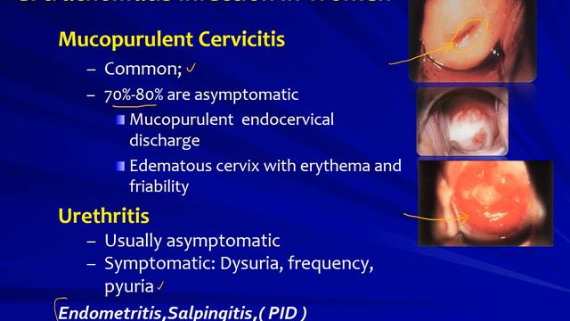 Chlamydial Infections: Spectrum of Clinical Presentation смотреть онлайн