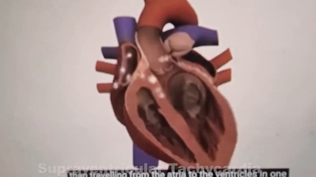 When your pulse rate is rapid смотреть онлайн