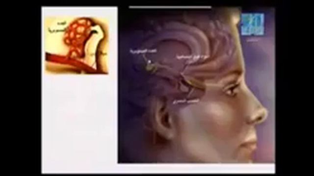 Куриное мясо полезен ли нам есть на чеченском