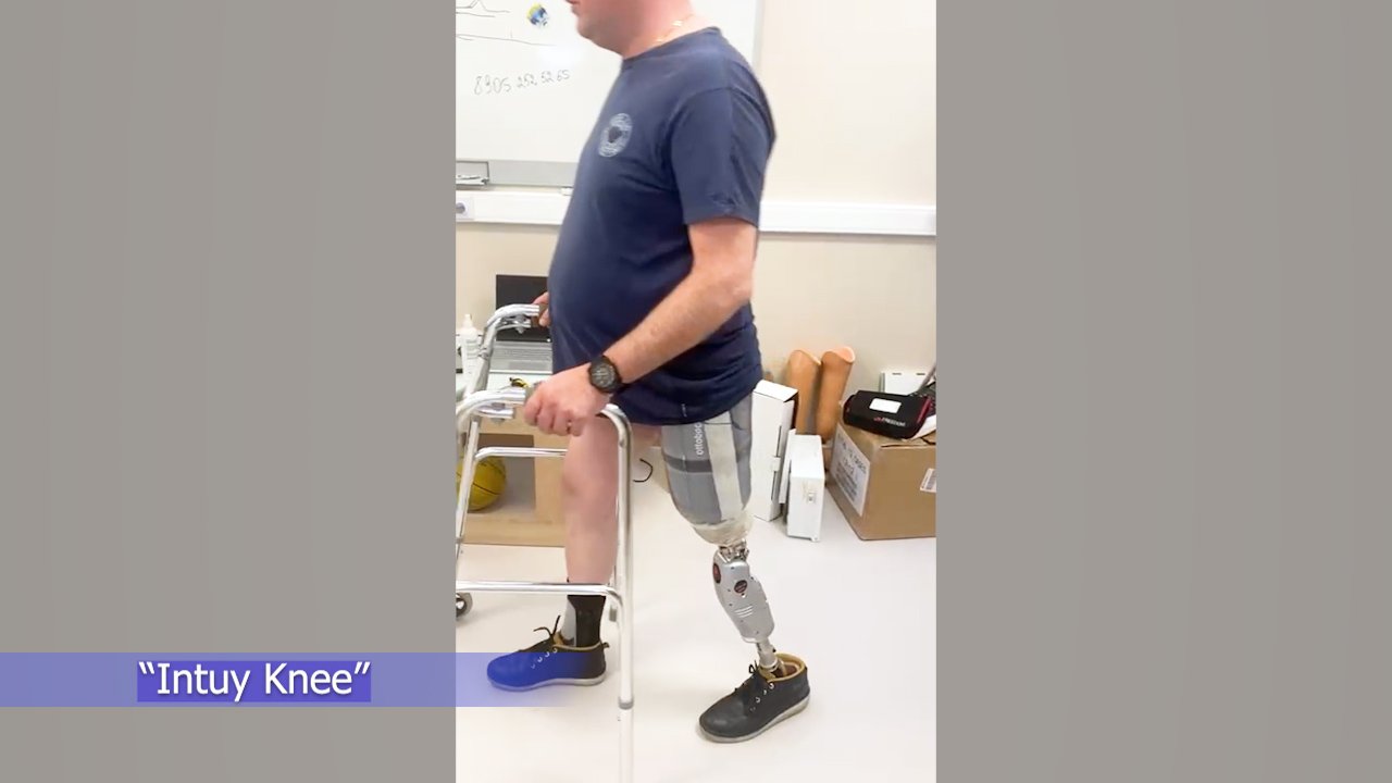 Впервые на протезе ноги с микропроцессором после 3-х месяцев ходьбы на лечебно-тренировочном протезе смотреть онлайн