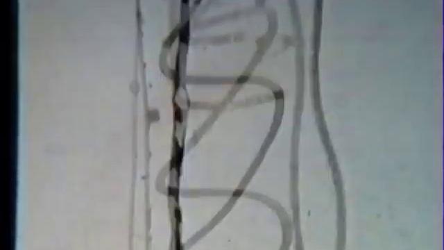 "Собачья шерсть" смотреть онлайн