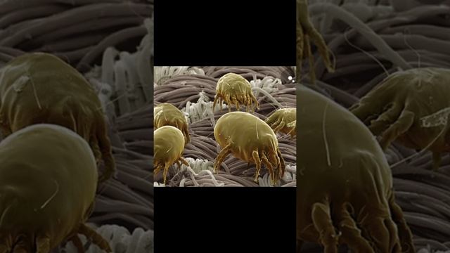 срочные новости! тканевые клещи у нас на подушке! смотреть онлайн