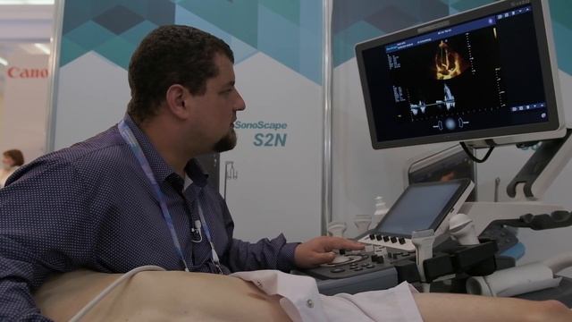 SonoScape S40Exp. Обзор и мастер-класс