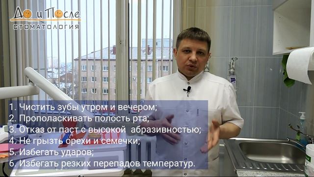 Как долго служат виниры смотреть онлайн