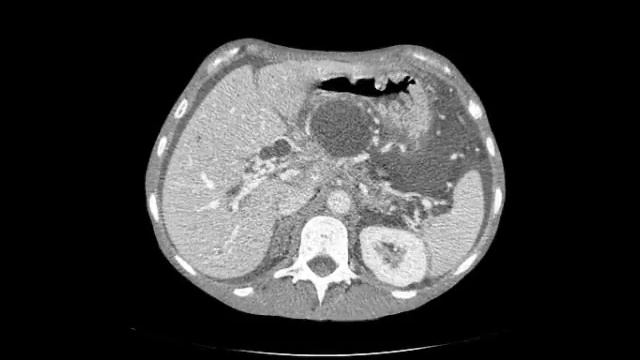 КТ портография.avi смотреть онлайн