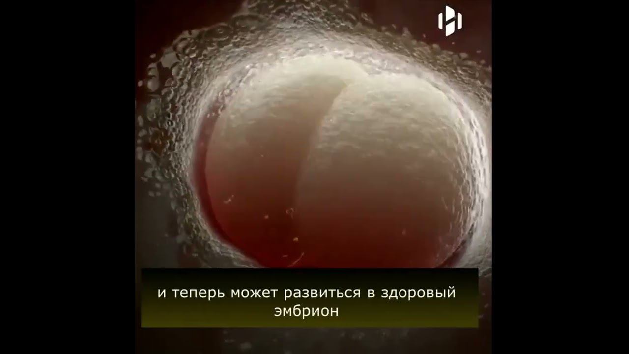 Взрыв света при зачатии смотреть онлайн