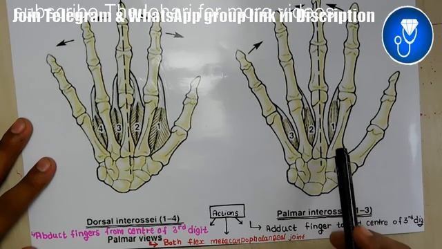 Palmar Interossei Muscles Of Hand | Dorsal Interossei Muscles Of Hand | Intrinsic Muscles Of Hand
