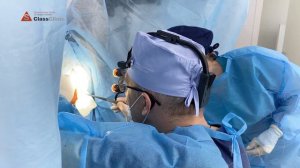 Удаление геморроя методом Лонго