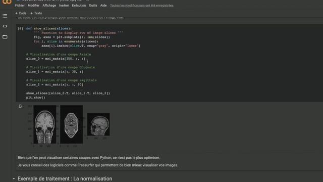 Comment traiter des IRM avec python смотреть онлайн