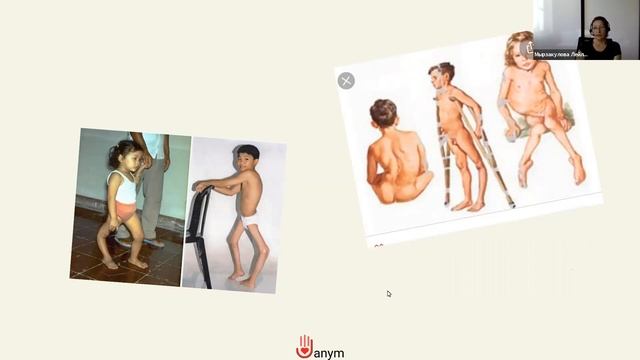 Вакцинация детей первого года жизни смотреть онлайн