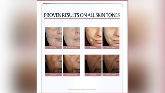 Eucerin Anti Pigment Skin Perfecting Serum REVIEW ENGLISH SUBTITLES#skincare #eucerin #nonsponsored смотреть онлайн