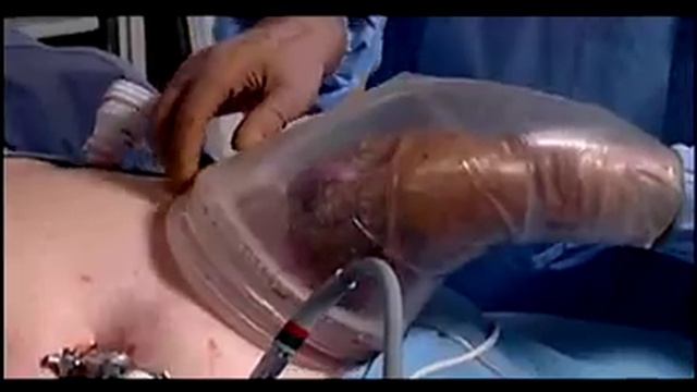 Pacific Laparoscopy - Educational Television смотреть онлайн