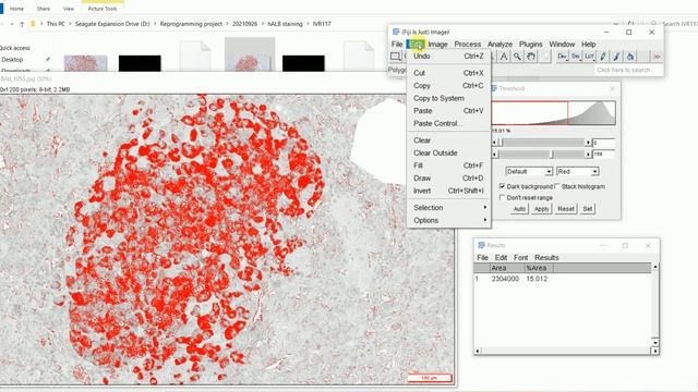 Quantification Of Immunohistochemistry Images Using ImageJ | How To Remove Background In ImageJ
