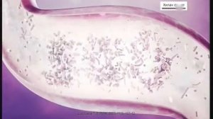 Реклама Хилак Форте: Выставка "500 видов полезных бактерий"