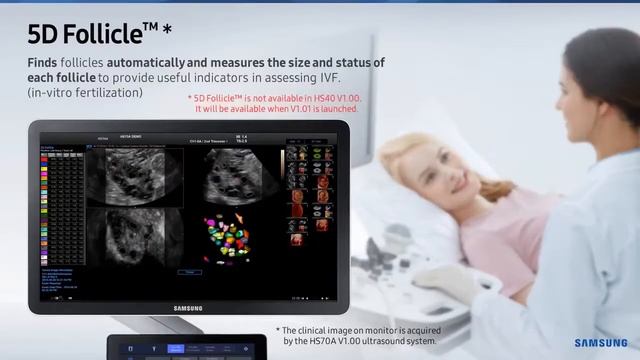 УЗИ-АППАРАТ SAMSUNG HS40 смотреть онлайн