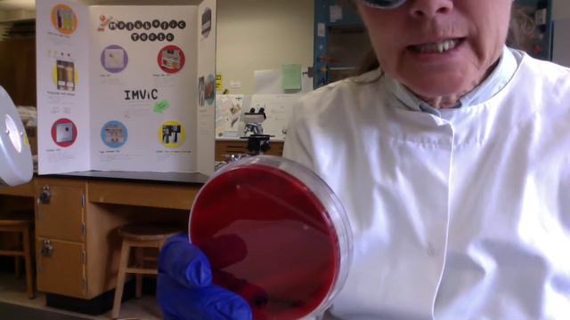 lab movie Ch 10 Blood agar results 3 15 2020 смотреть онлайн