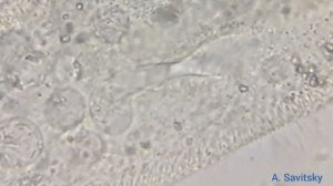 Питание инфузории туфельки / Feeding ciliate Paramecium caudatum