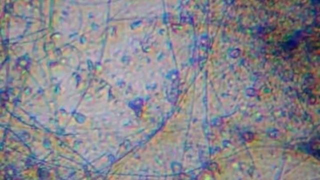 Бактерии и микробы под микроскопом видео смотреть онлайн