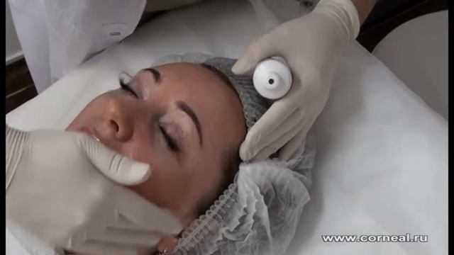 Самонейтрализующийся пилинг - всего минута смотреть онлайн