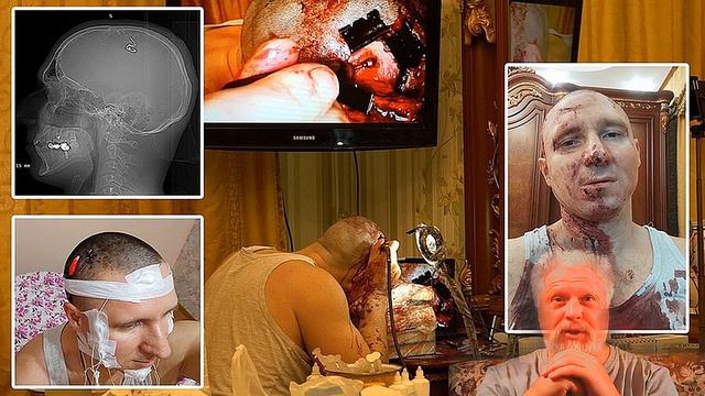 "Михаил Радуга", жуткий мазохизм; - фазовая шизофрения продолжается! смотреть онлайн