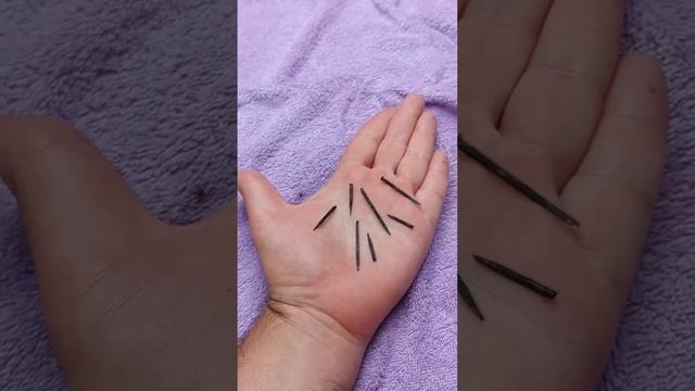 Как избавиться от укола морского ежа. смотреть онлайн