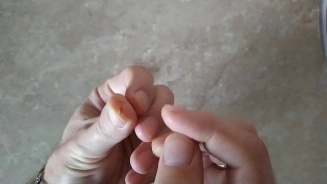 Трескается кожа на пальцах рук. Как просо и бесплатно я избавился от этой проблемы. смотреть онлайн