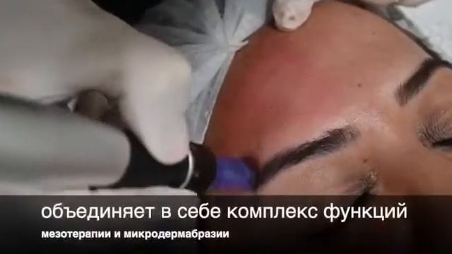 Dermapen /дермапен