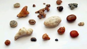 чистка почек. камни и песок в почках