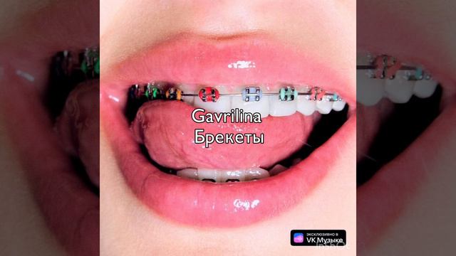 speed song брекеты gavrilina смотреть онлайн