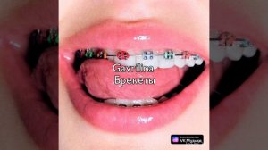 speed song брекеты gavrilina