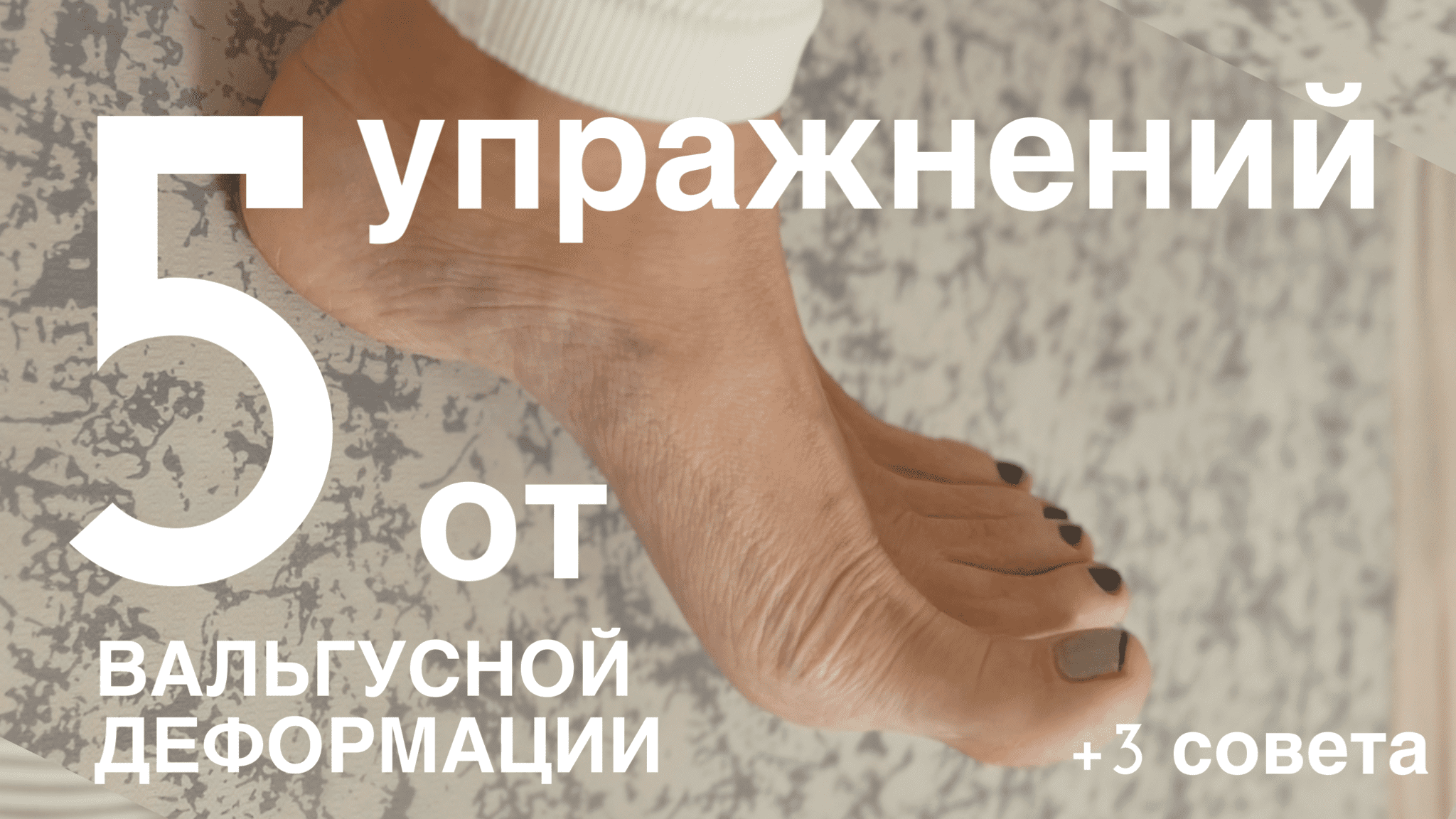 5 упражнений против вальгусной деформации стоп смотреть онлайн