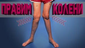 ❌-образные колени. Как исправить?