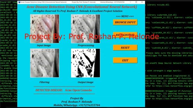 Acne Disease Detection Using Image Processing | With Source Code | Python Project смотреть онлайн