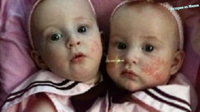 ? Увидев результаты УЗИ, доктора советовали ей сделать АБOРТ, НО материнское сердце было ПРОТИВ... смотреть онлайн