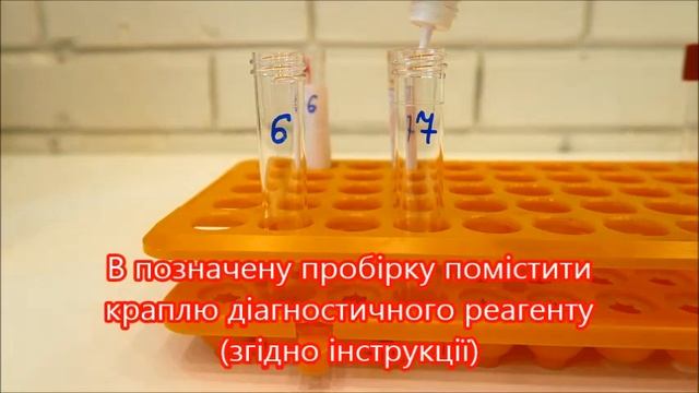 Реакція аглютинації. Определение группы крови, реакция аглютинации смотреть онлайн