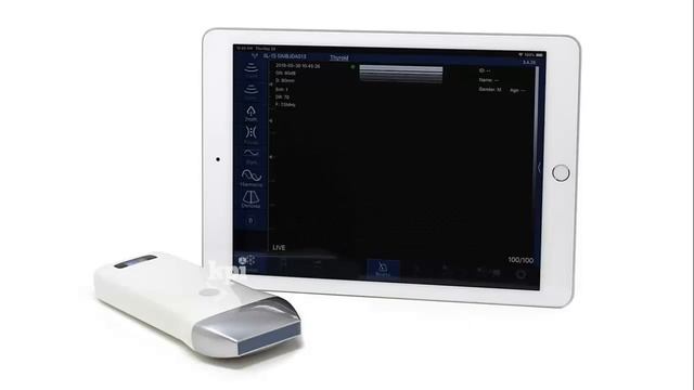 Top 5 Best Portable Ultrasound Scanner Machine 2019 and 2020 смотреть онлайн