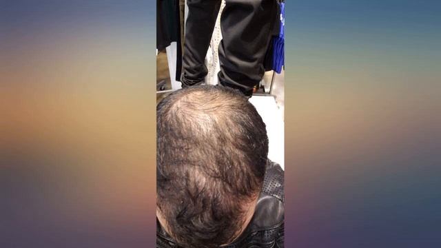 KIRKLAND SIGNATURE Minoxidil for Men 5% Minoxidil Hair Regrowth Treatment 12 Months review смотреть онлайн