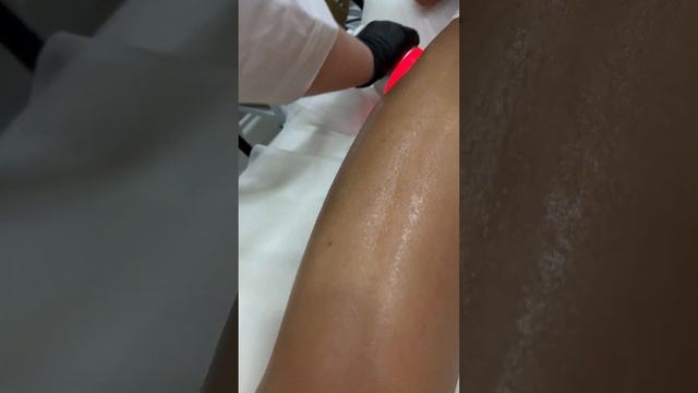 Вакуумный массаж для коррекции фигуры!