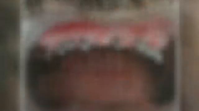 Basal Dental Implants смотреть онлайн