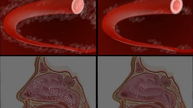 Pseudoephedrine Spanish смотреть онлайн
