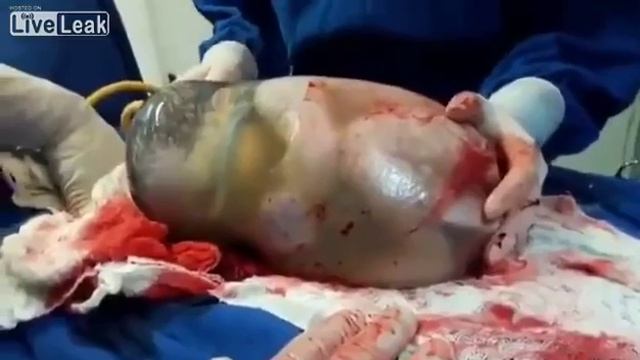 Удивительное Рождение Ребенка смотреть онлайн