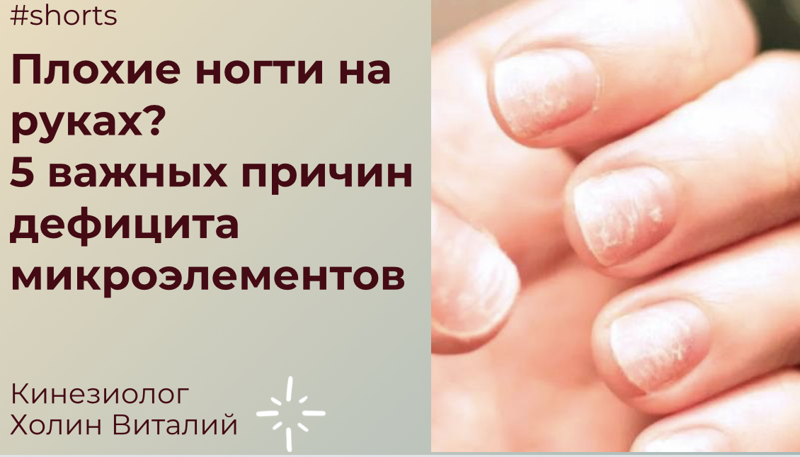 Плохие ногти на руках?
5 важных причин дефицита микроэлементов смотреть онлайн