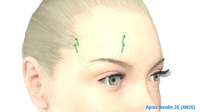 Aptos Needle 2G AN2G смотреть онлайн