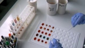 определение групп крови перекрёстным методом и резус-фактора